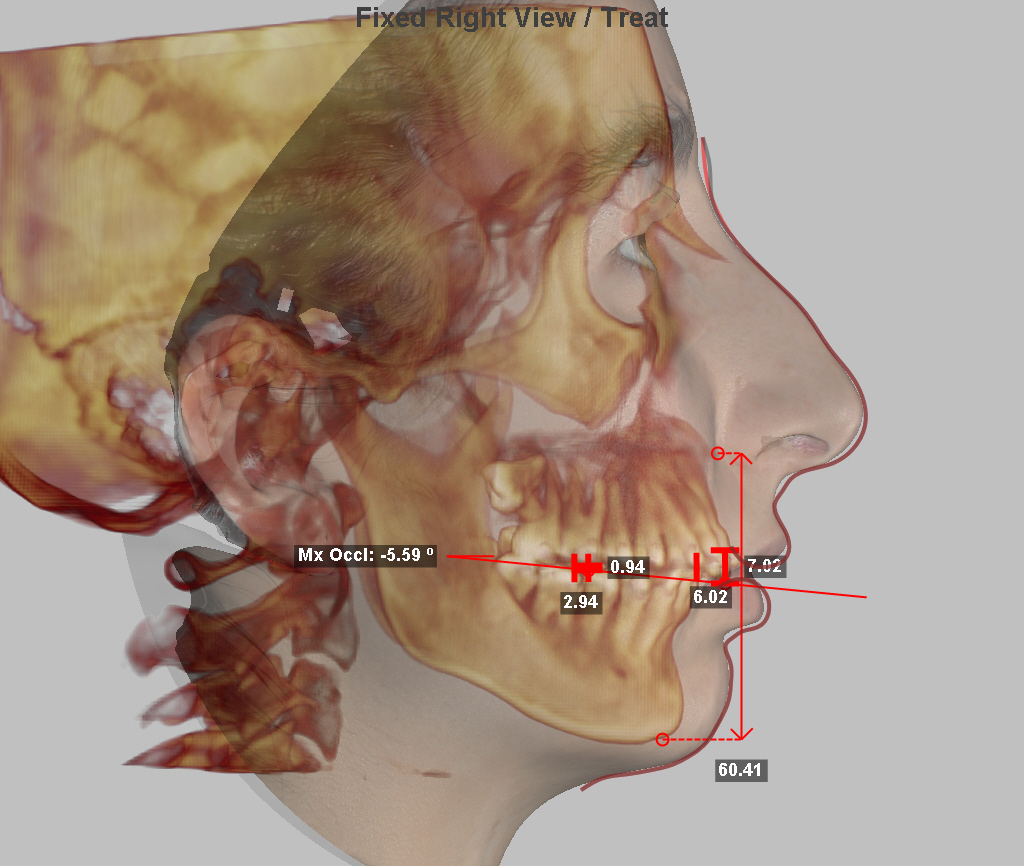 Компьютерная томография лицевого скелета и фотография лица.