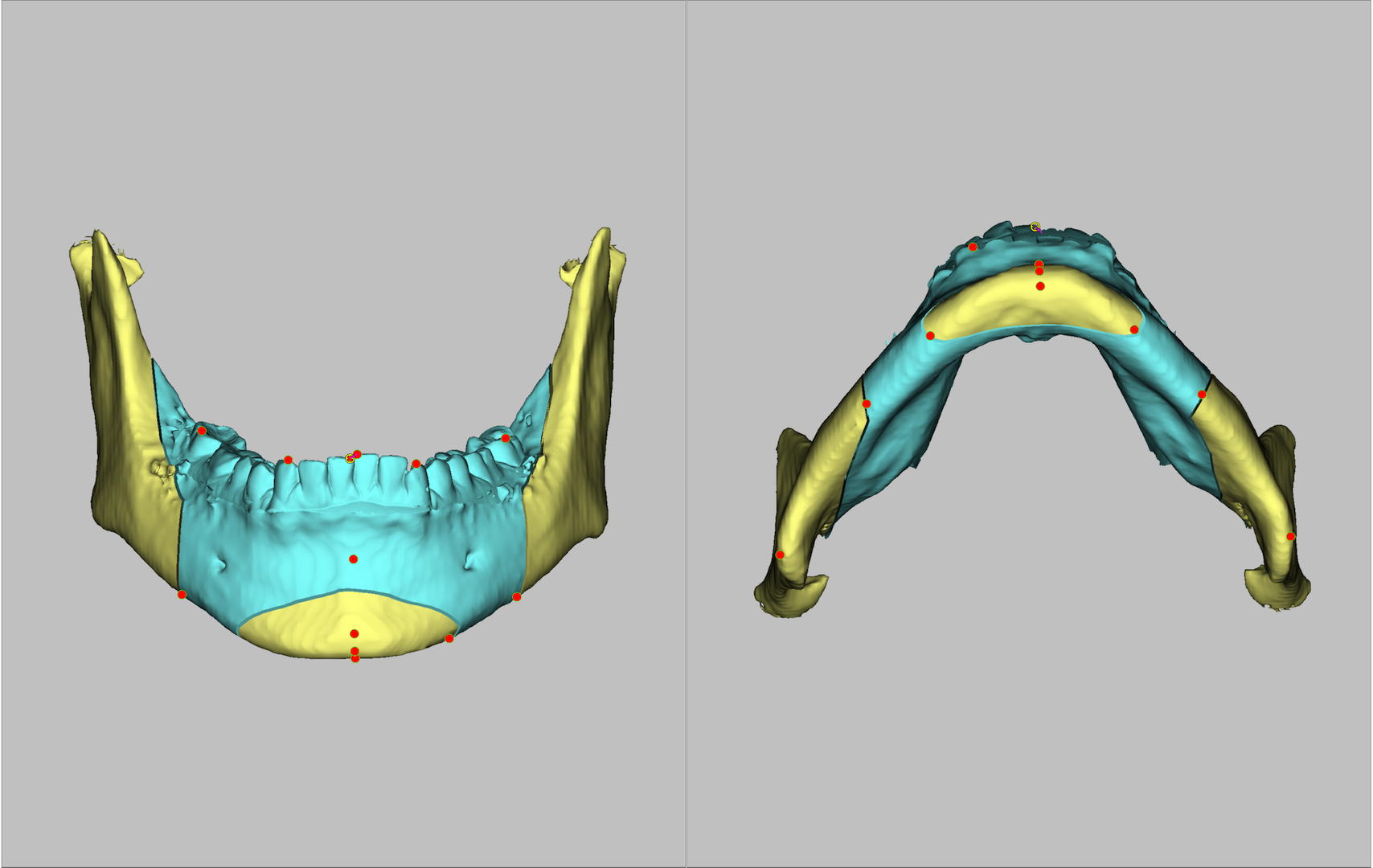 Рис. 9. Цефалометрические ориентиры в виде точек спроецированы на костные структуры лицевого скелета и зубы
